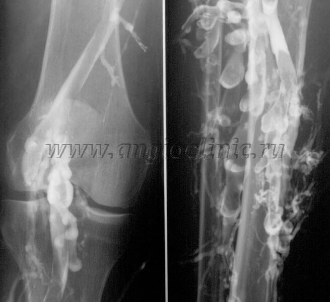 المسح بالموجات فوق الصوتية